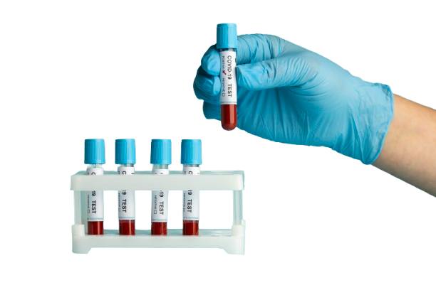hand-with-protective-gloves-holding-blood-samples-covid-test-removebg-preview
