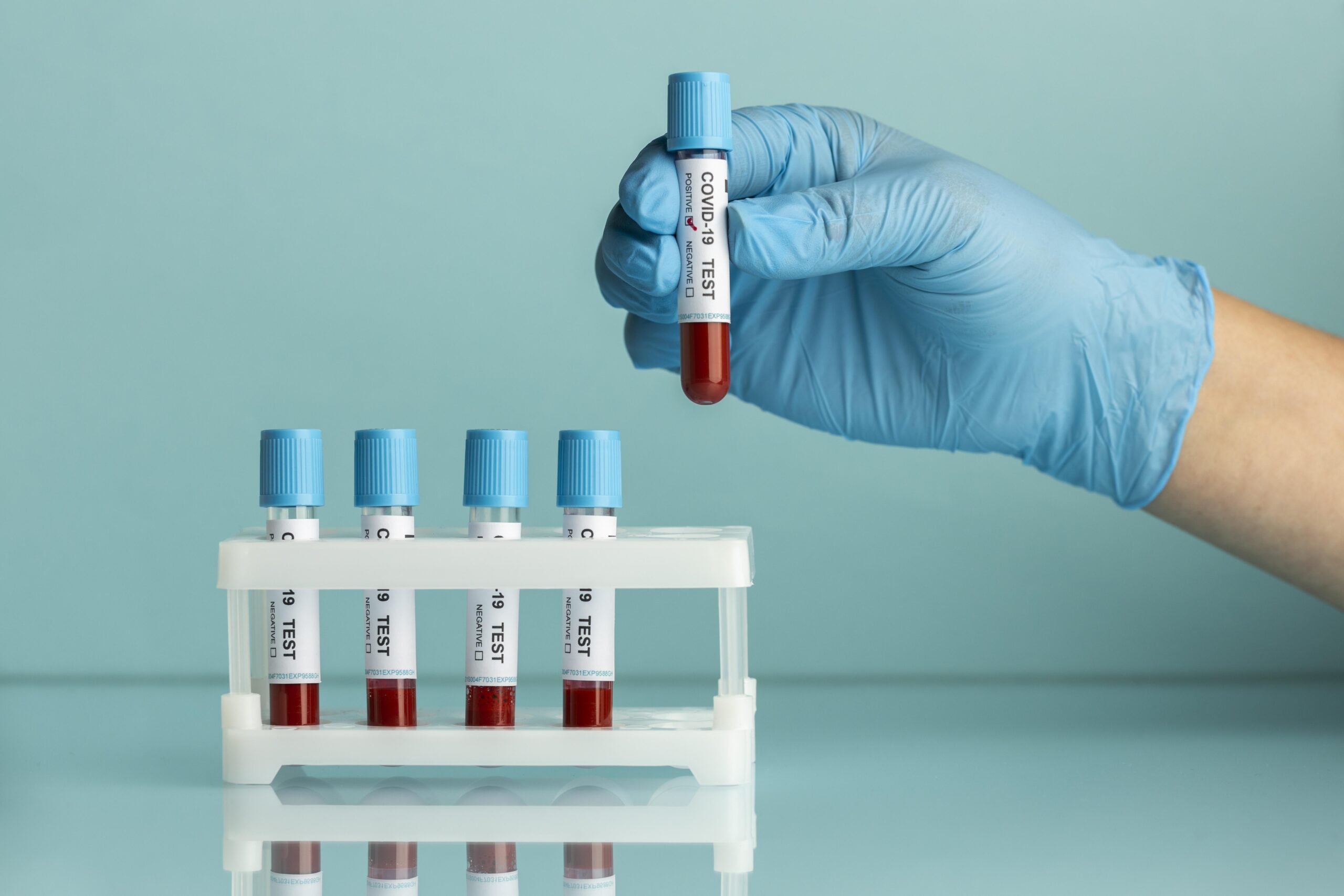 hand-with-protective-gloves-holding-blood-samples-covid-test